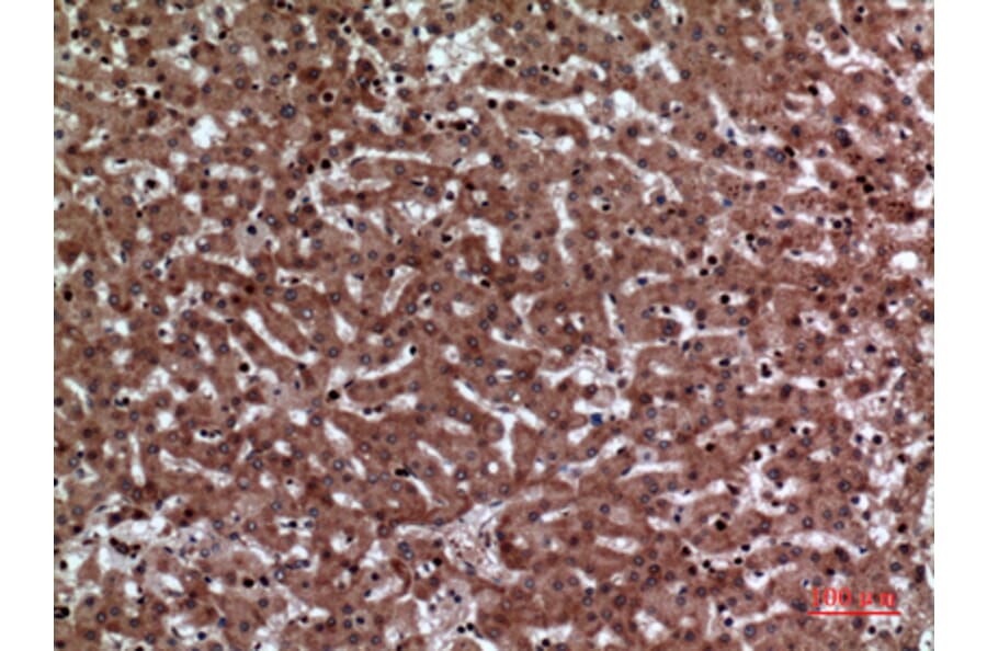 Immunohistochemistry - Anti-F11R Antibody (C30522) - Antibodies.com