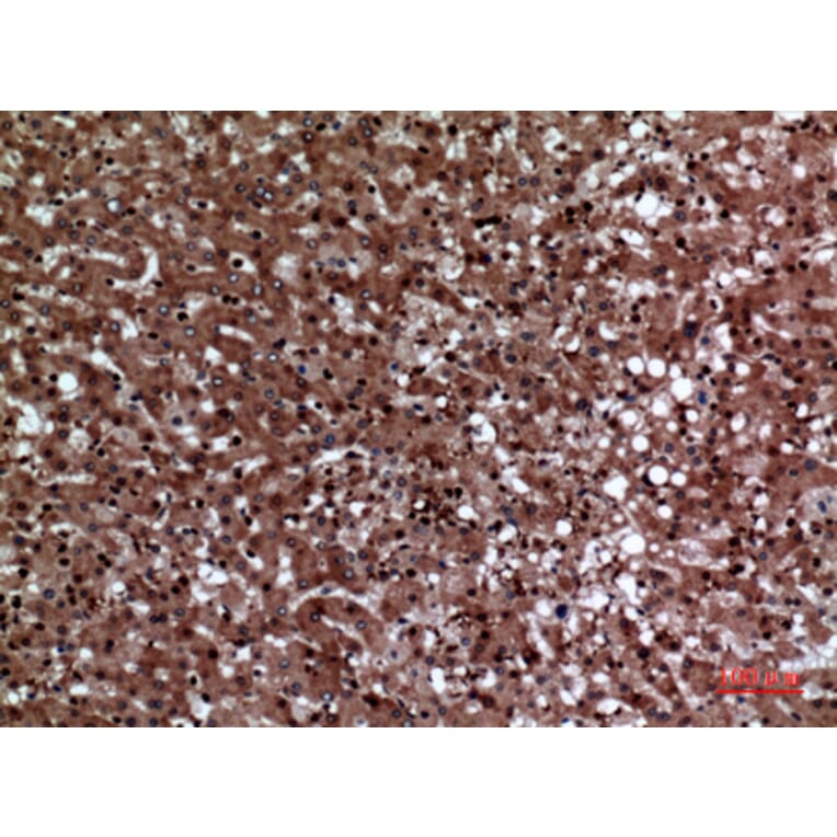 Immunohistochemistry - Anti-F11R Antibody (C30522) - Antibodies.com