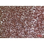 Immunohistochemistry - Anti-F11R Antibody (C30522) - Antibodies.com