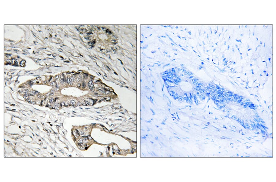 Immunohistochemistry - Anti-EPN3 Antibody (C15668) - Antibodies.com