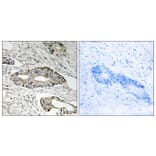 Immunohistochemistry - Anti-EPN3 Antibody (C15668) - Antibodies.com