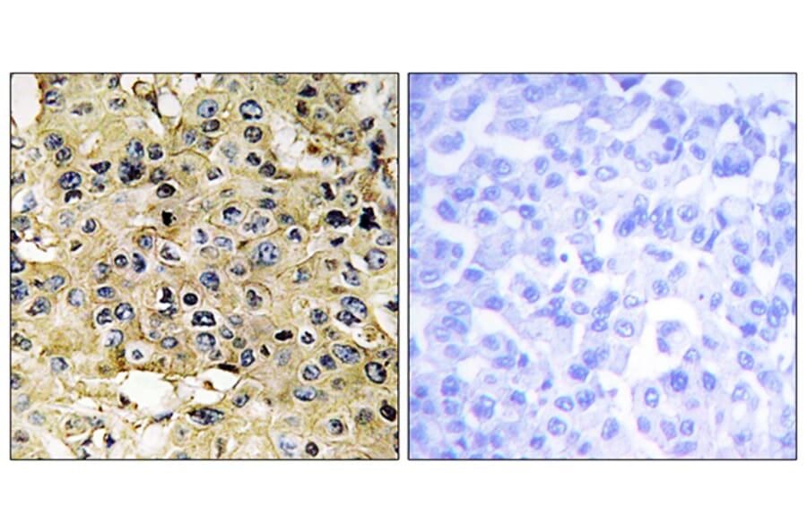 Immunohistochemistry - Anti-ENTK Antibody (C10813) - Antibodies.com