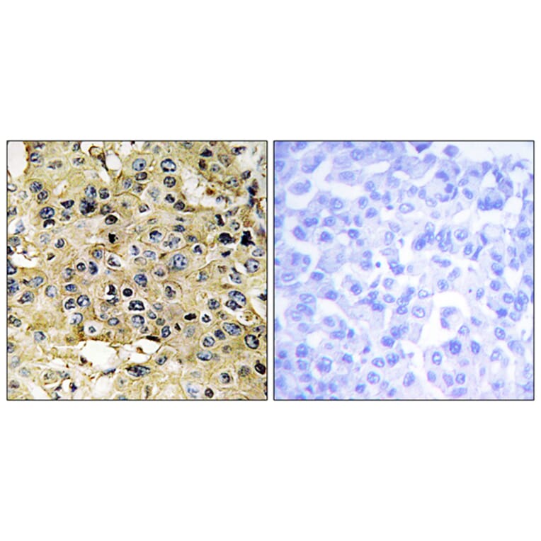 Immunohistochemistry - Anti-ENTK Antibody (C10813) - Antibodies.com