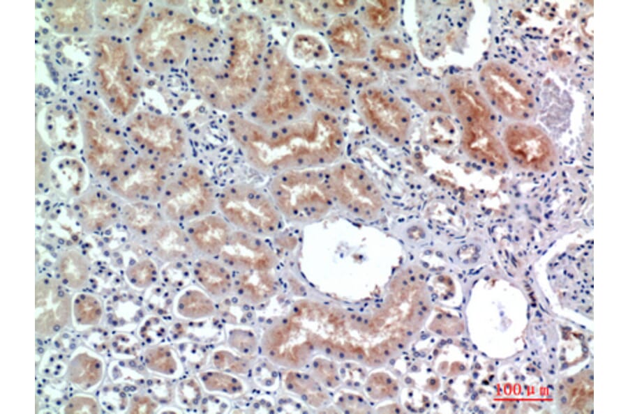 Immunohistochemistry - Anti-DPP4 Antibody (C30338) - Antibodies.com