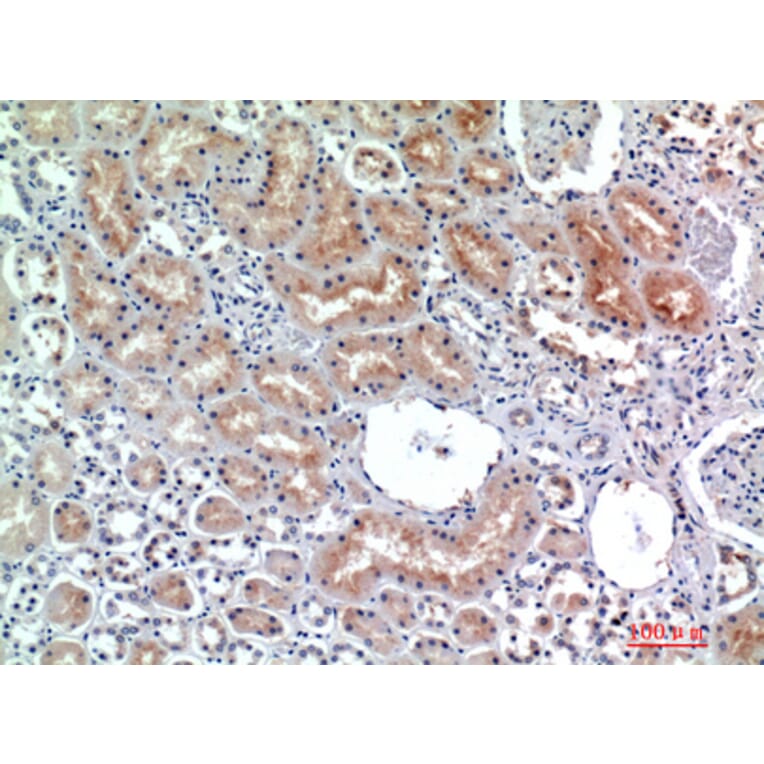 Immunohistochemistry - Anti-DPP4 Antibody (C30338) - Antibodies.com