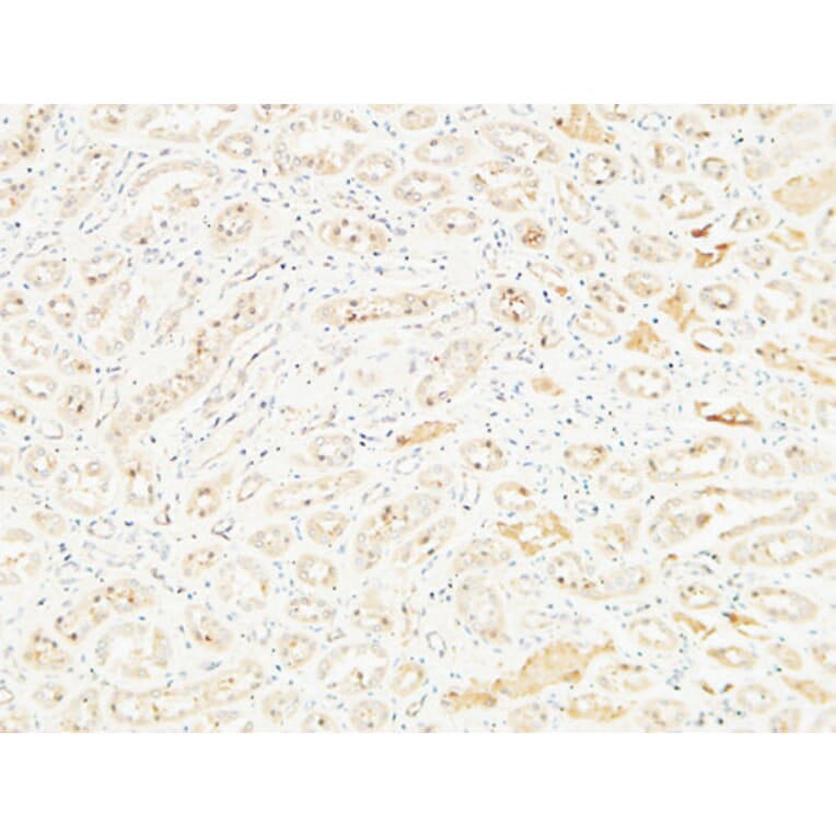 Immunohistochemistry - Anti-DPP4 Antibody (C30338) - Antibodies.com