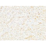 Immunohistochemistry - Anti-DPP4 Antibody (C30338) - Antibodies.com