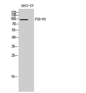 Western blot analysis of 293T UV cells using Anti-DLG2 Antibody.