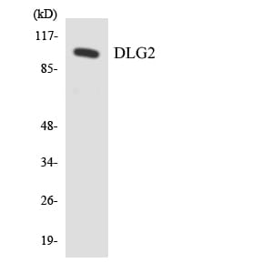 Western blot analysis of the lysates from HeLa cells using Anti-DLG2 Antibody.