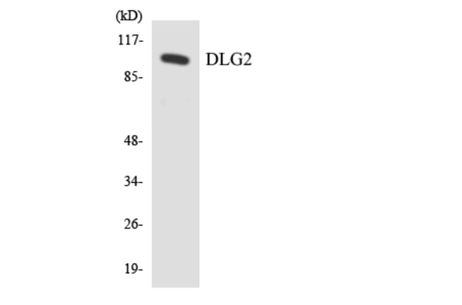 Western Blot - Anti-DLG2 Antibody (R12-2701) - Antibodies.com