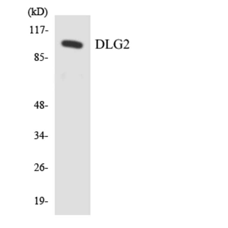 Western Blot - Anti-DLG2 Antibody (R12-2701) - Antibodies.com