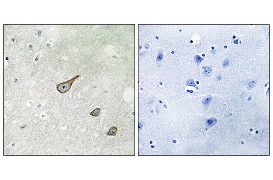 Immunohistochemistry - Anti-DGKK Antibody (C11181) - Antibodies.com