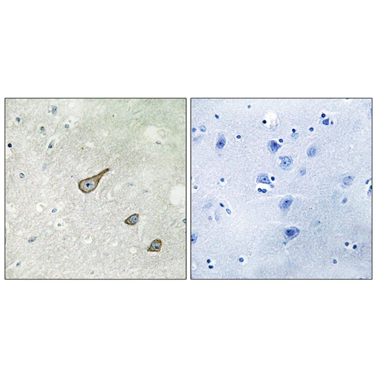 Immunohistochemistry - Anti-DGKK Antibody (C11181) - Antibodies.com