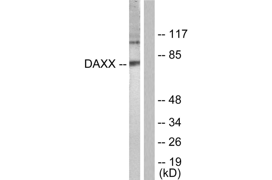 Western Blot - Anti-Daxx Antibody (B0419) - Antibodies.com