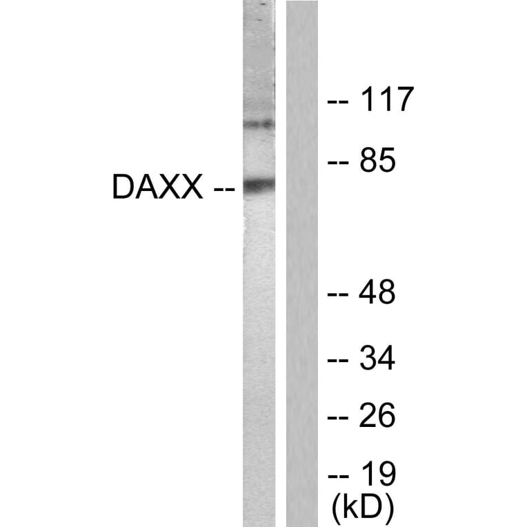 Western Blot - Anti-Daxx Antibody (B0419) - Antibodies.com