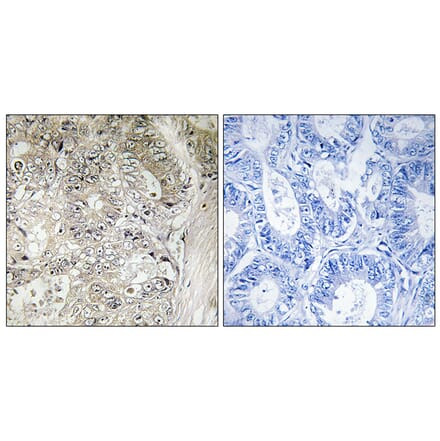Immunohistochemistry - Anti-CST1 Antibody (C15283) - Antibodies.com