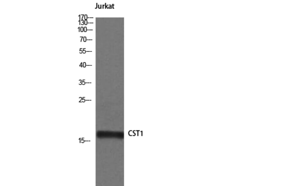 Western Blot - Anti-CST1 Antibody (C15283) - Antibodies.com