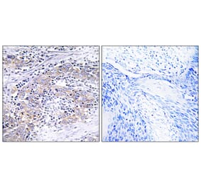 Immunohistochemistry - Anti-CLN6 Antibody (C15062) - Antibodies.com