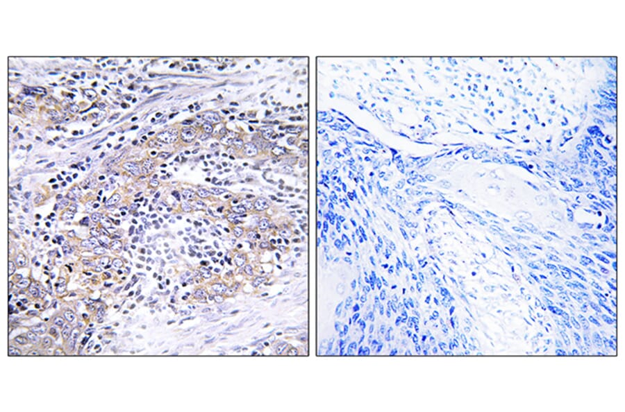 Immunohistochemistry - Anti-CLN6 Antibody (C15062) - Antibodies.com