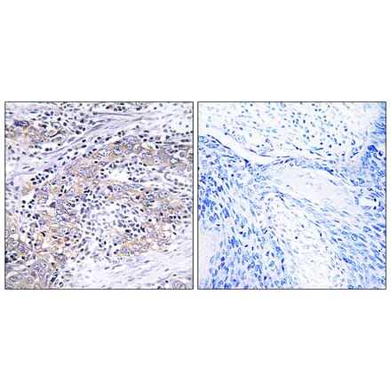 Immunohistochemistry - Anti-CLN6 Antibody (C15062) - Antibodies.com