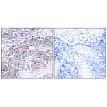 Immunohistochemistry - Anti-CLN6 Antibody (C15062) - Antibodies.com