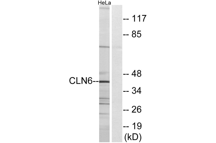 Western Blot - Anti-CLN6 Antibody (C15062) - Antibodies.com