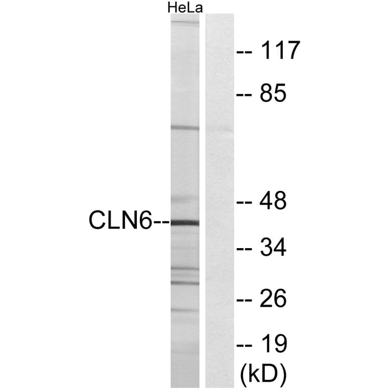 Western Blot - Anti-CLN6 Antibody (C15062) - Antibodies.com