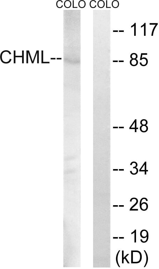 Western blot analysis of lysates from COLO cells using Anti-CHML Antibody. The right hand lane represents a negative control, where the antibody is blocked by the immunising peptide.