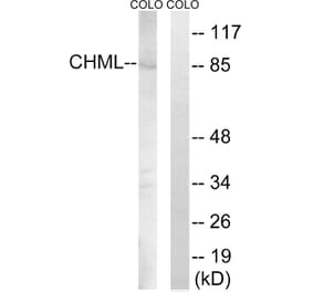 Western Blot - Anti-CHML Antibody (C18118) - Antibodies.com