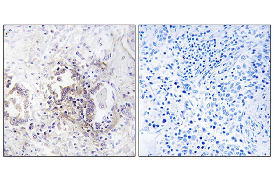Immunohistochemistry - Anti-CHML Antibody (C18118) - Antibodies.com