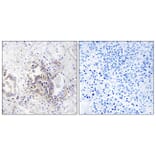 Immunohistochemistry - Anti-CHML Antibody (C18118) - Antibodies.com