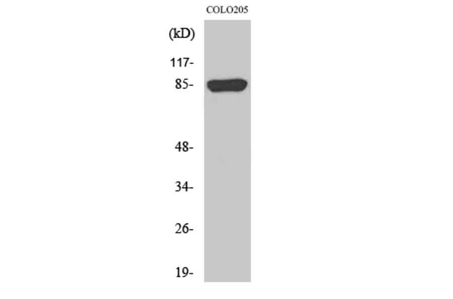 Western Blot - Anti-CHML Antibody (C18118) - Antibodies.com