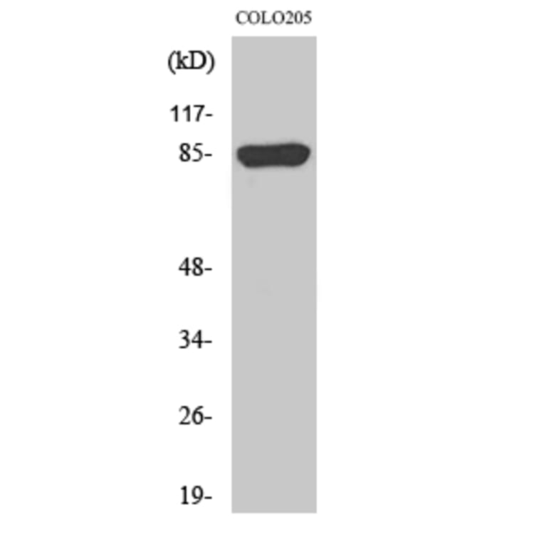 Western Blot - Anti-CHML Antibody (C18118) - Antibodies.com