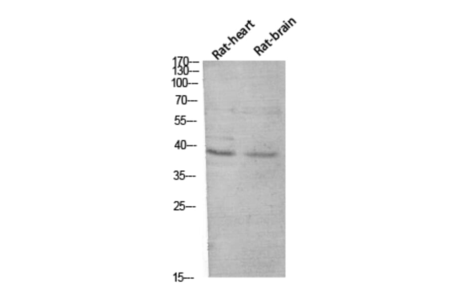 Western Blot - Anti-CER1 Antibody (C30601) - Antibodies.com
