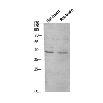 Western Blot - Anti-CER1 Antibody (C30601) - Antibodies.com