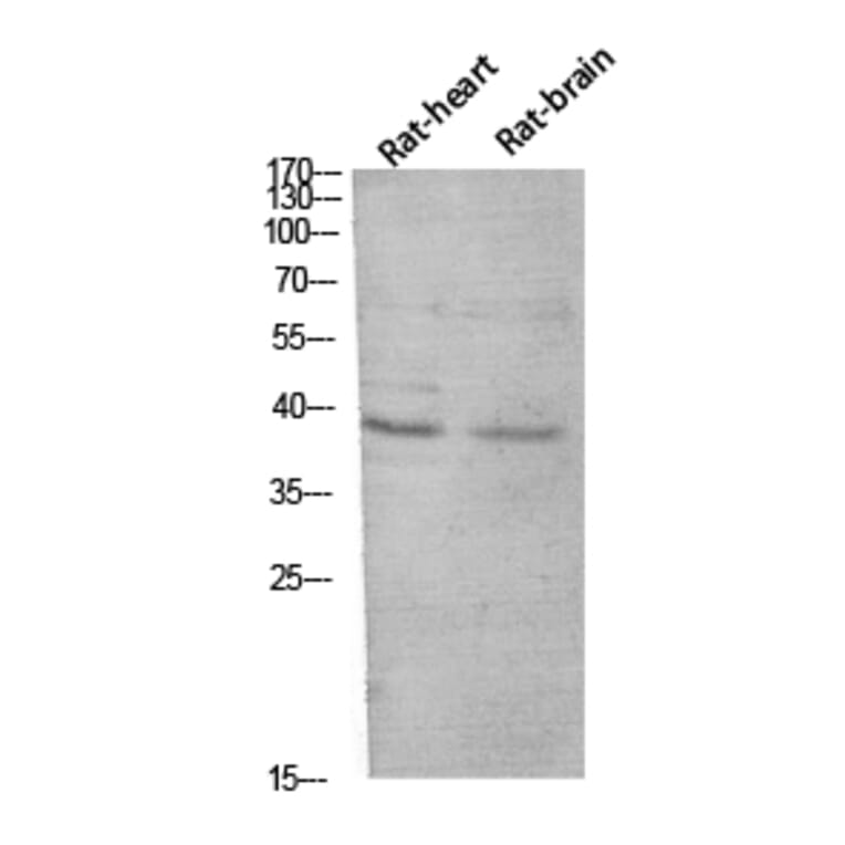 Western Blot - Anti-CER1 Antibody (C30601) - Antibodies.com