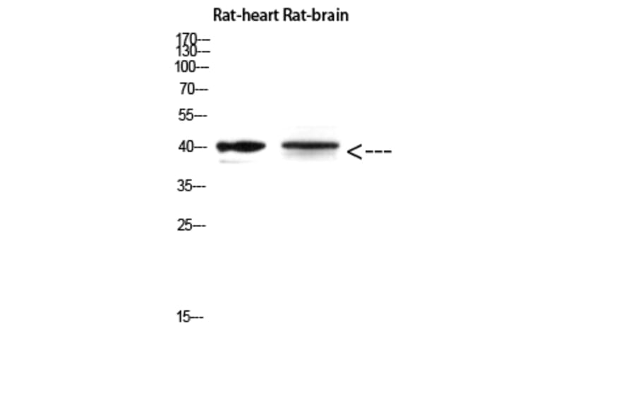 Western Blot - Anti-CER1 Antibody (C30601) - Antibodies.com