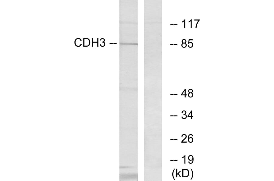 Western Blot - Anti-CDH3 Antibody (C12101) - Antibodies.com