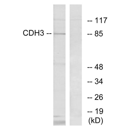 Western Blot - Anti-CDH3 Antibody (C12101) - Antibodies.com