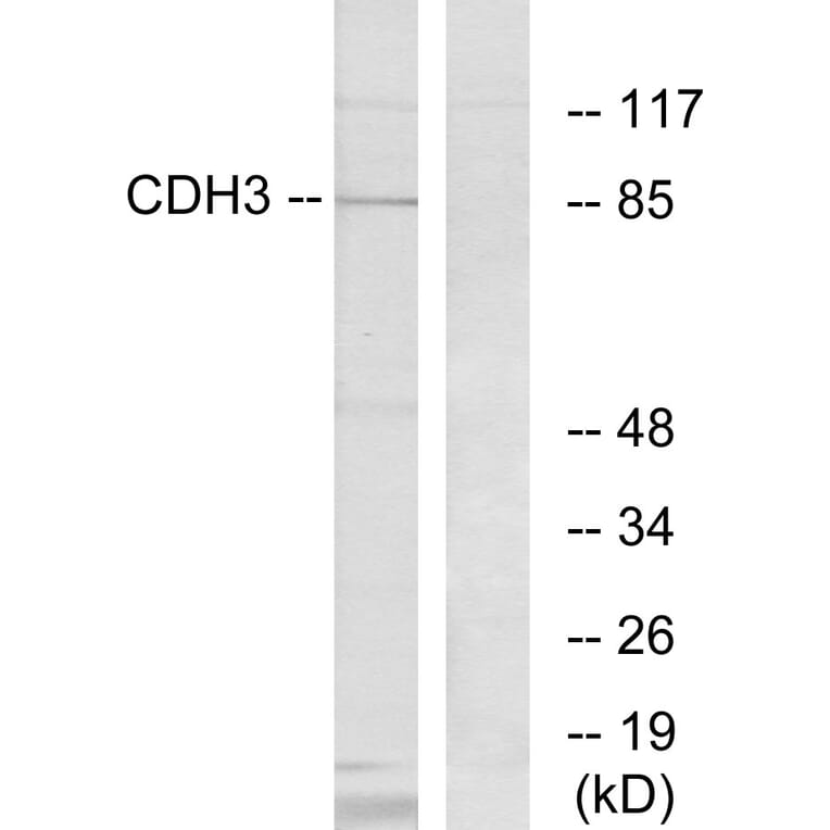 Western Blot - Anti-CDH3 Antibody (C12101) - Antibodies.com