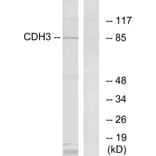 Western Blot - Anti-CDH3 Antibody (C12101) - Antibodies.com