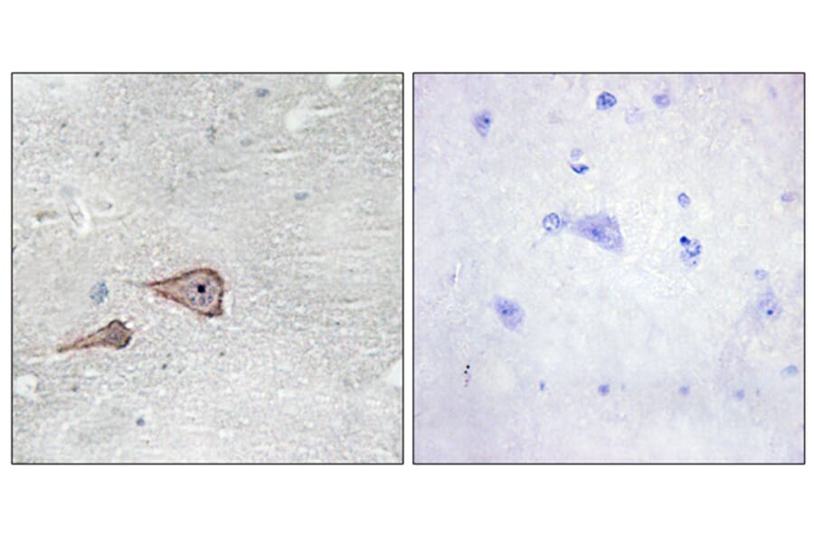 Immunohistochemistry - Anti-CDH3 Antibody (C12101) - Antibodies.com