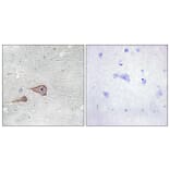 Immunohistochemistry - Anti-CDH3 Antibody (C12101) - Antibodies.com