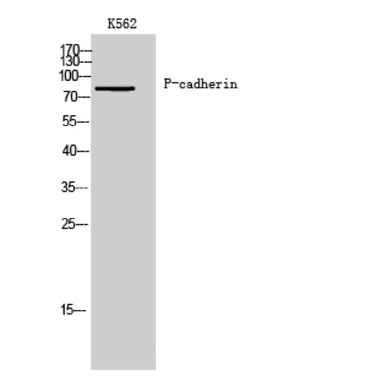 Western Blot - Anti-CDH3 Antibody (C12101) - Antibodies.com