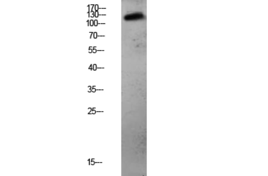 Western Blot - Anti-CDH3 Antibody (C12101) - Antibodies.com