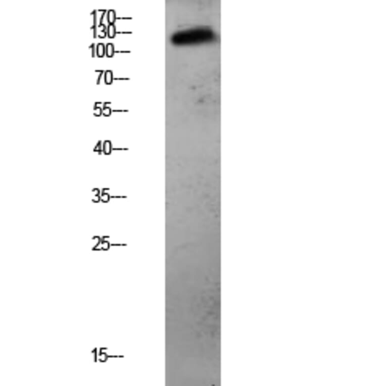 Western Blot - Anti-CDH3 Antibody (C12101) - Antibodies.com