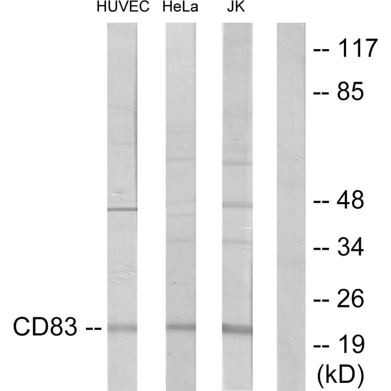 Western Blot - Anti-CD83 Antibody (C12161) - Antibodies.com