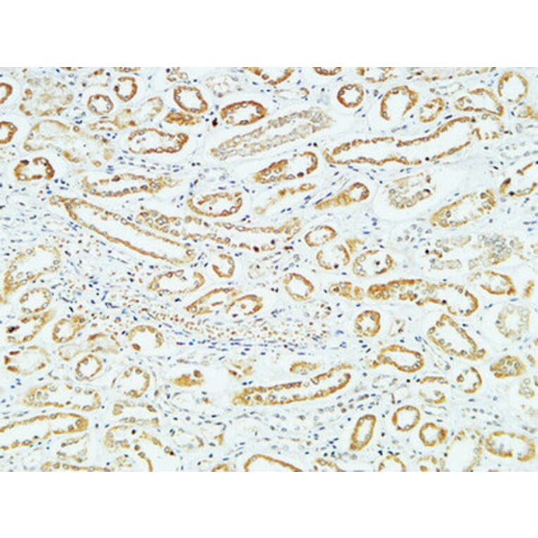 Immunohistochemistry - Anti-CD83 Antibody (C12161) - Antibodies.com