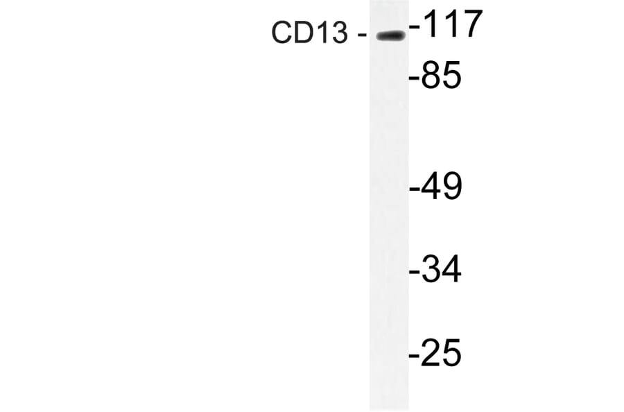 Western Blot - Anti-CD13 Antibody (R12-2065) - Antibodies.com