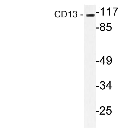 Western Blot - Anti-CD13 Antibody (R12-2065) - Antibodies.com